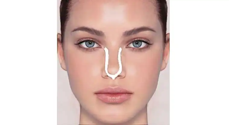 چسب زدن بینی مراحل