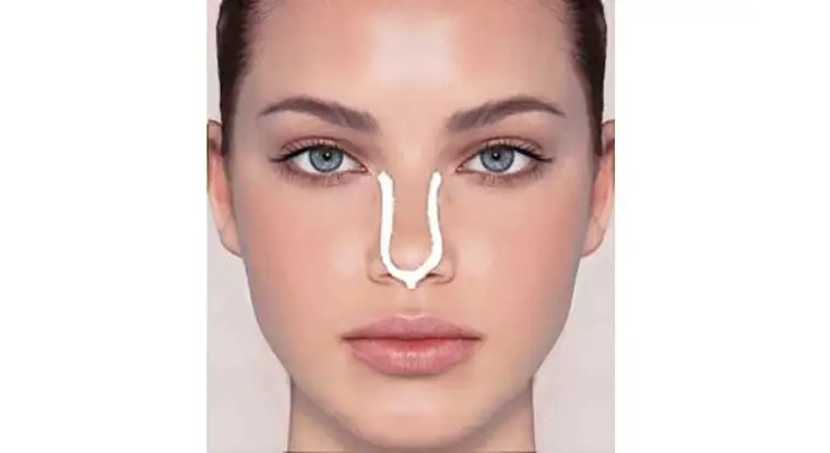 چسب زدن بینی مراحل