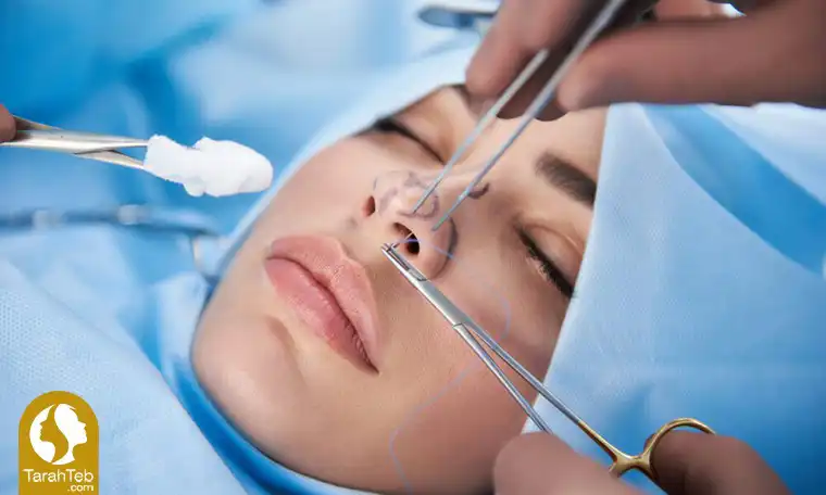 چه چیزی باید در مورد جراحی زیبایی بینی بدانم