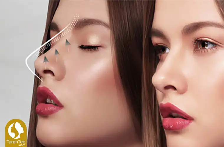 چگونه بینی خود را بدون جراحی تغییر دهیم؟