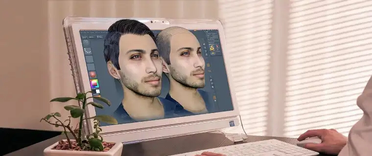کاشت موی سه بعدی