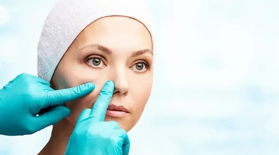کلوئید یا گوشت اضافه بعد از عمل بینی
