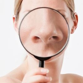 Alar reduction surgery
