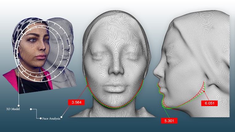 Three-dimensional design for gel and Botox injection