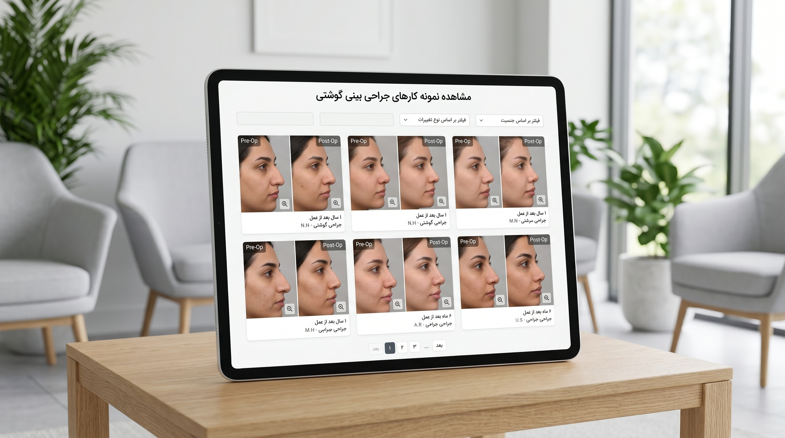 عکس قبل و بعد عمل بینی گوشتی، چه نتیجهای واقعبینانه است؟