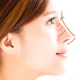 تغییر شکل بینی بدون جراحی