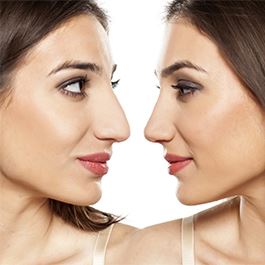 روش‌های کوچک کردن بینی