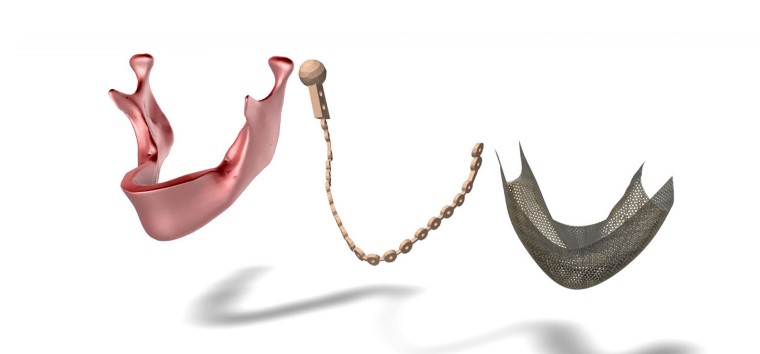 طراحی و تولید پروتز فک