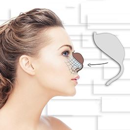 قالب کنترلی و روش اجرای آن