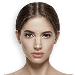 پیوند غضروف در عمل بینی